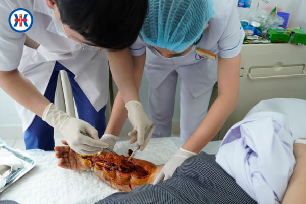 Khoa Ngoại – Bệnh viện Đa khoa Quốc tế Hải Phòng – Vĩnh Bảo “Cứu lại thành công cánh tay cho nữ bệnh nhân trẻ bị chèn ép khoang do tai nạn lao động”