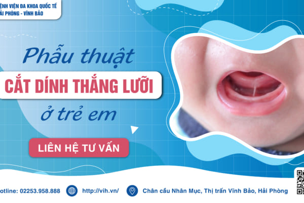 Cắt thắng lưỡi không đau, không chảy máu tại Bệnh viện đa khoa Quốc tế Hải Phòng – Vĩnh Bảo
