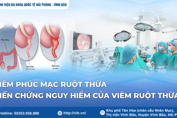 Viêm phúc mạc ruột thừa – Biến chứng nguy hiểm của viêm ruột thừa