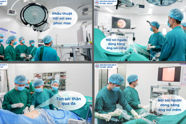 Các phương pháp điều trị sỏi tiết niệu tại BV đa khoa Quốc tế Hải Phòng –  Vĩnh Bảo