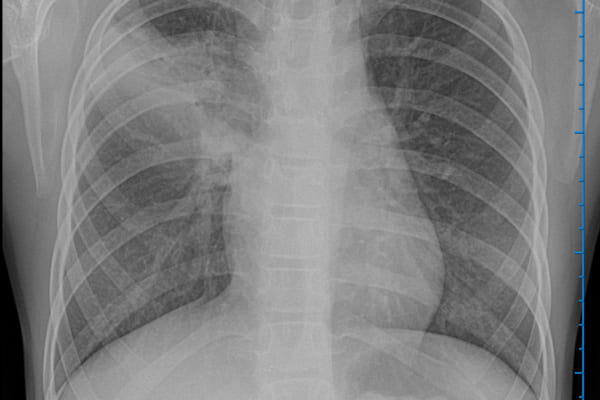 𝑽𝒊𝒆̂𝒎 𝒑𝒉𝒐̂̉𝒊 𝑴𝒚𝒄𝒐𝒑𝒍𝒂𝒔𝒎𝒂 – 𝑩𝒆̣̂𝒏𝒉 𝒏𝒈𝒖𝒚 𝒉𝒊𝒆̂̉𝒎 𝒄𝒂́𝒄 𝒃𝒂̣̂𝒄 𝒄𝒉𝒂 𝒎𝒆̣ 𝒌𝒉𝒐̂𝒏𝒈 𝒏𝒆̂𝒏 𝒄𝒉𝒖̉ 𝒒𝒖𝒂𝒏