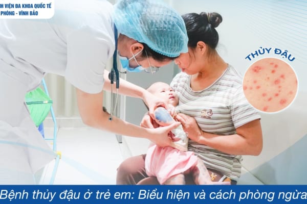 BỆNH THỦY ĐẬU Ở TRẺ EM: BIỂU HIỆN VÀ CÁCH PHÒNG NGỪA