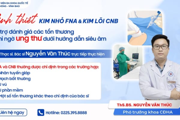 SINH THIẾT KIM NHỎ (FNA) & SINH THIẾT KIM LÕI (CNB) – HỖ TRỢ ĐÁNH GIÁ CÁC TỔN THƯƠNG NGHI NGỜ UNG THƯ DƯỚI HƯỚNG DẪN SIÊU ÂM